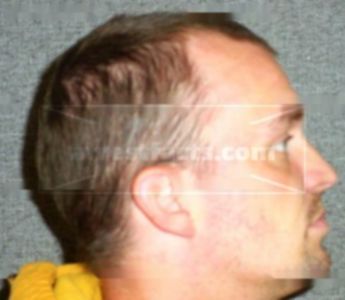 Travis J Mcdermott