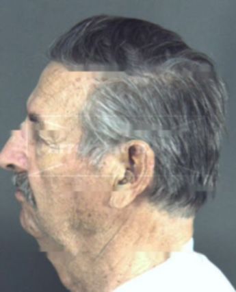 Bert Phillips