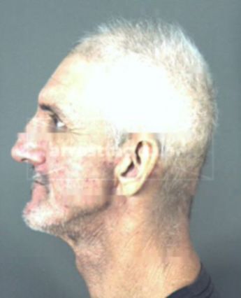 Thomas Mendel Glisson