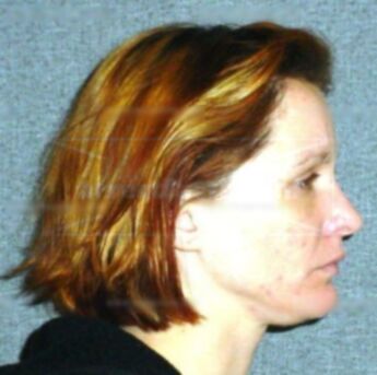Natalie A Winiarczyk