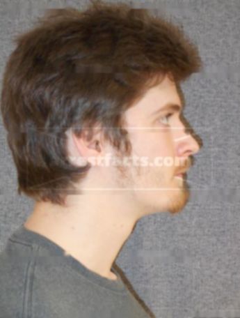 Nicholas J Milberger