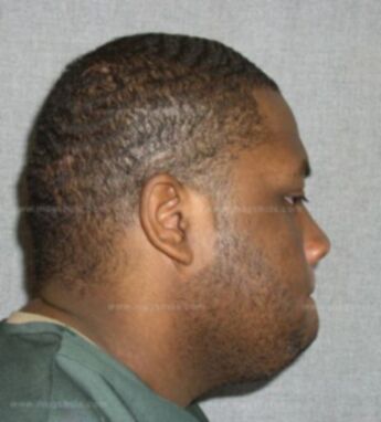Marcus Coleman
