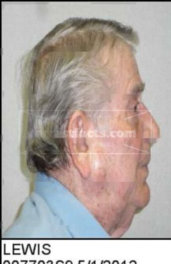 Jerry Gray Lewis