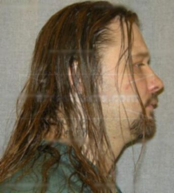 Mickey Luedke
