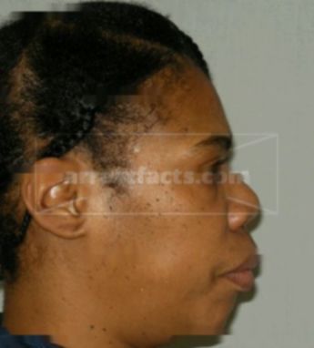 Loran Trotter