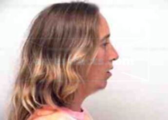 Belinda Jo Barnett