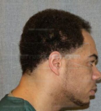 Parnell Milton
