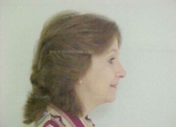 Anita L Seigal