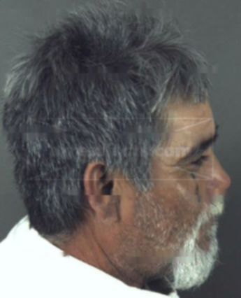 Noel Canto