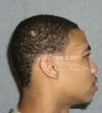 Deandre L. Bradshaw