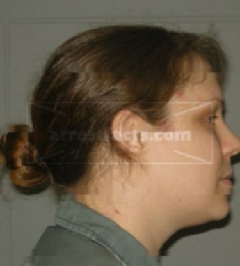 Rochelle C Stoneback