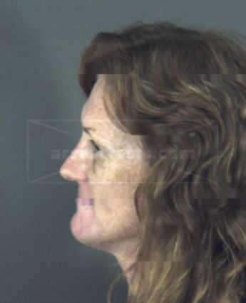Jeanie Lynn Pringle