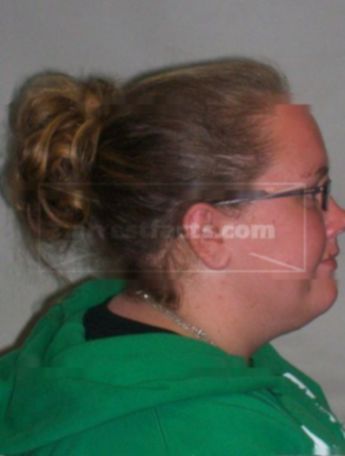 Lindsey J Hillyer