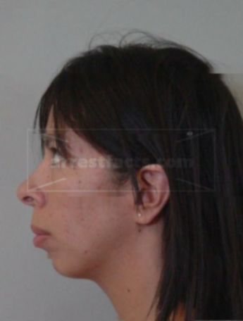 Roseann Bernal