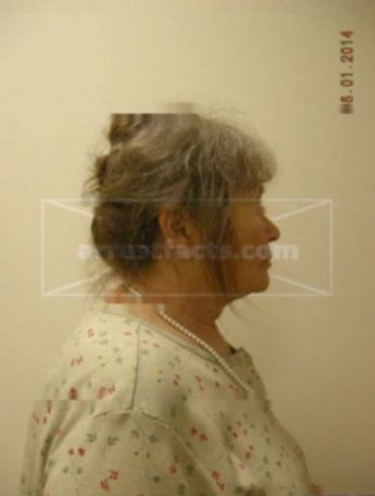 Barbara J Thiry