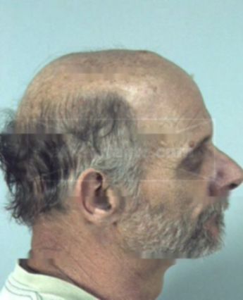 Raymond L Bardwell