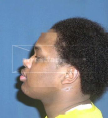 Rico Jermaine Nash