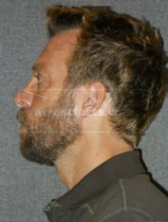Michael V Simon