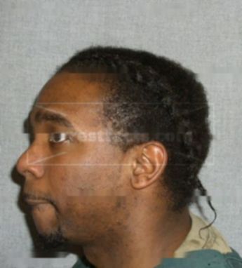 Matthew P Guyton