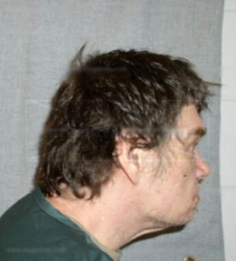 Richard L Lareau