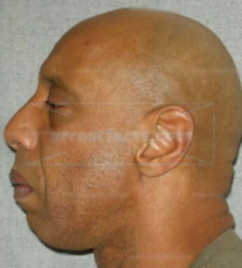Jeffrey L Mosley