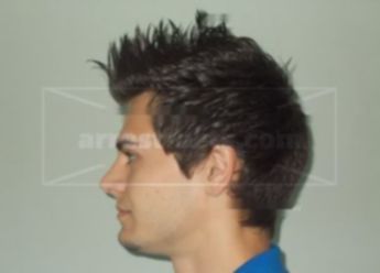 Christopher J Barebo