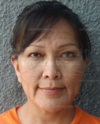 Lucinda M Tomchee