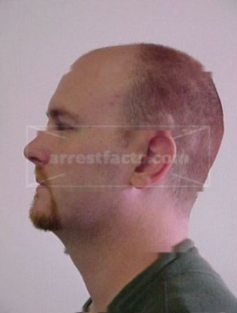 Matthew C Eddings