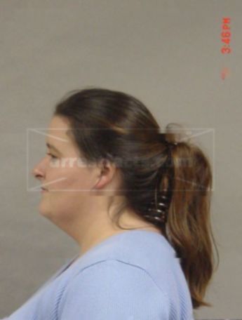 Jennifer L Winn