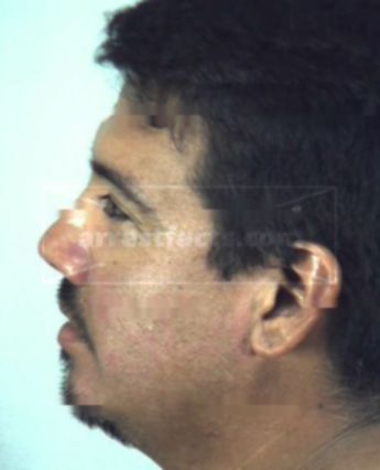 Jose Antonio Gonzales