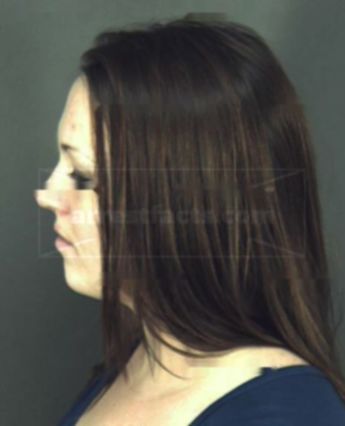 Elizabeth Anna Kietzman