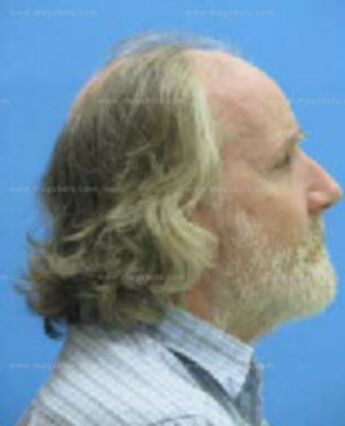 Philip Harrison Kern