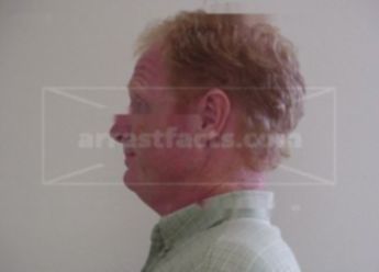 Richard E Gauger