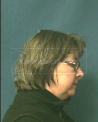 Susan L Silver
