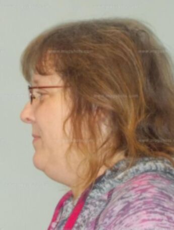Lisa M Finn