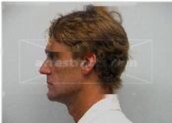 Bryan Carr Quick