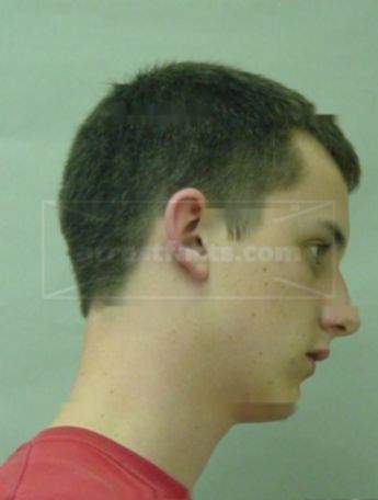 Tyler L Hurth