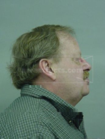 Reid W Bergren
