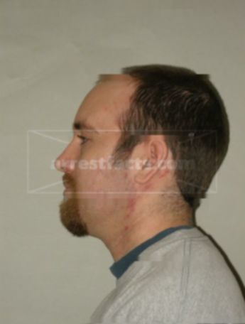 Joshua Stewart Erdman