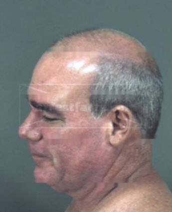 Patrick Joseph Mcardle Jr