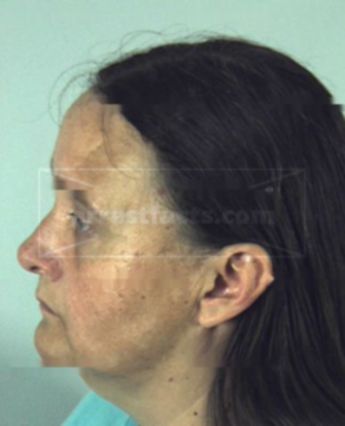 Patricia Lynn Davis