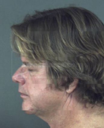 Bret Allen Zigler