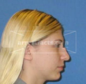 Ashley Ann Sever