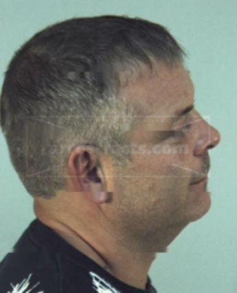 Brent Allan Cole