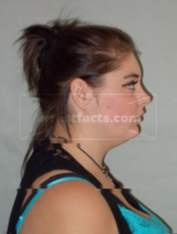 Lacey J Wentz