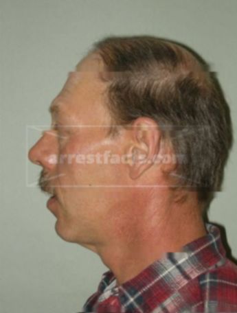 Larry Haessly