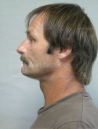 Richard A Andrus
