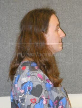 Lisa M Kasten