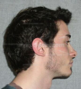 Kevin Pimental