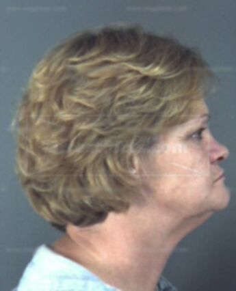 Carmen F Pyle